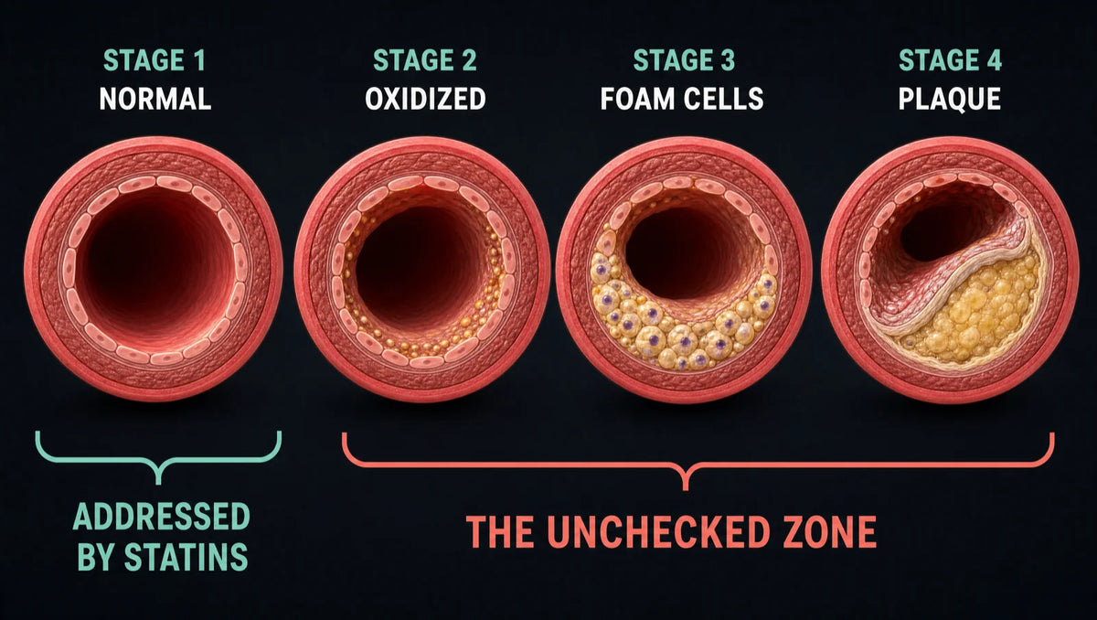 The four-stage cascade. Your cholesterol number only measures stage one — the oxidation that drives stages two through four runs unmeasured.